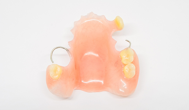 レジン床義歯 